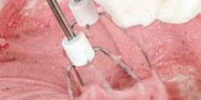 Шаг 2: мусса клюквенного из манной крупы