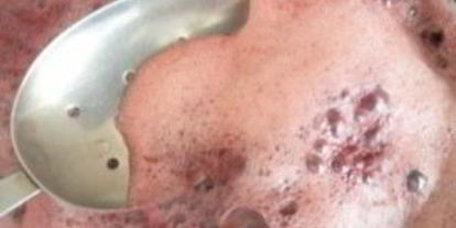 Шаг 2: киселя из смородинового варенья