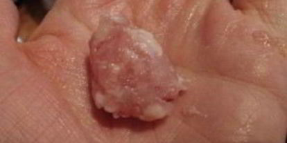 Шаг 2: супа с куриными фрикадельками и овощами