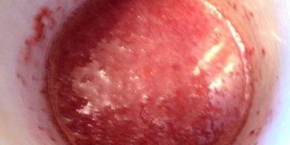 Шаг 7: торта клубника со сливками