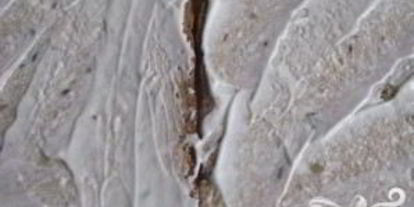 Шаг 1: сэндвичей с яйцом